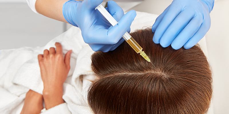 raised acne scar treatment